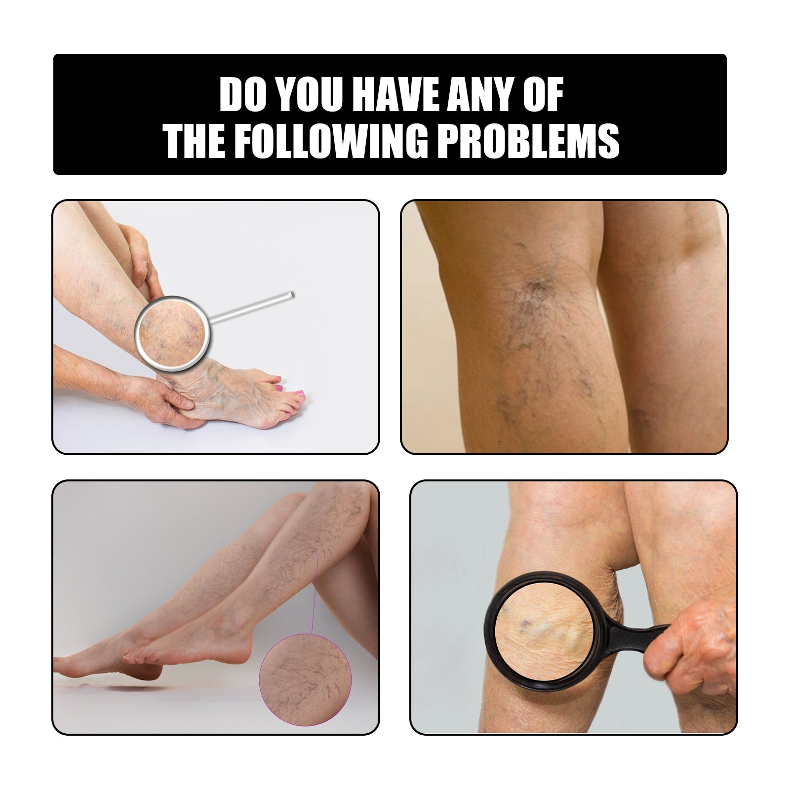 Vein Repair Patch To Relieve Pain And Swelling Earthworm Leg Blue Veins Repair Plaster