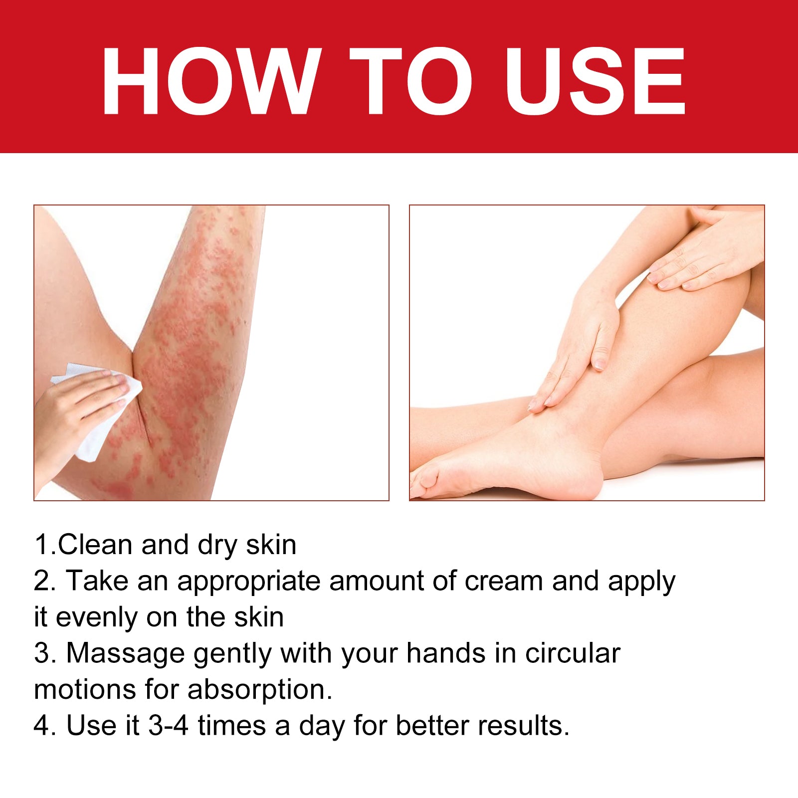XiMonth Ultra Soothing Cream, Relieve Mosquito Bites Prickly Rash Skin Red And Itchy Skin Care Cream
