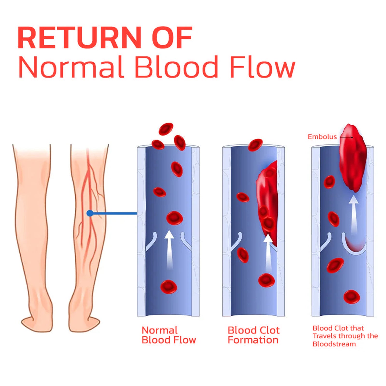 Far Infrared Tourmaline Acupressure Insoles, Vein Repair Body Care Slimming Body Anti-Slip Wear Arch Support Insoles