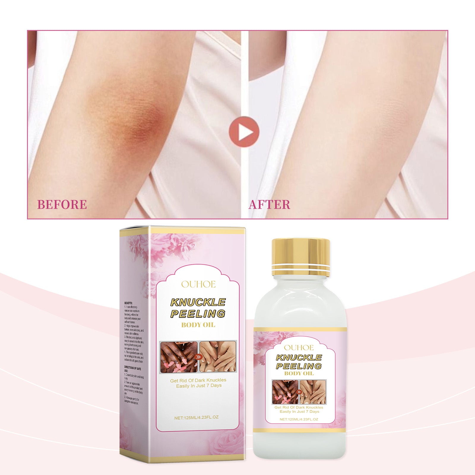 Ouhoe Knuckle Peeling Oil Body Whitening Concentrate, Deep Moisturizing And Nourishing Joint Peeling Body Care Essence