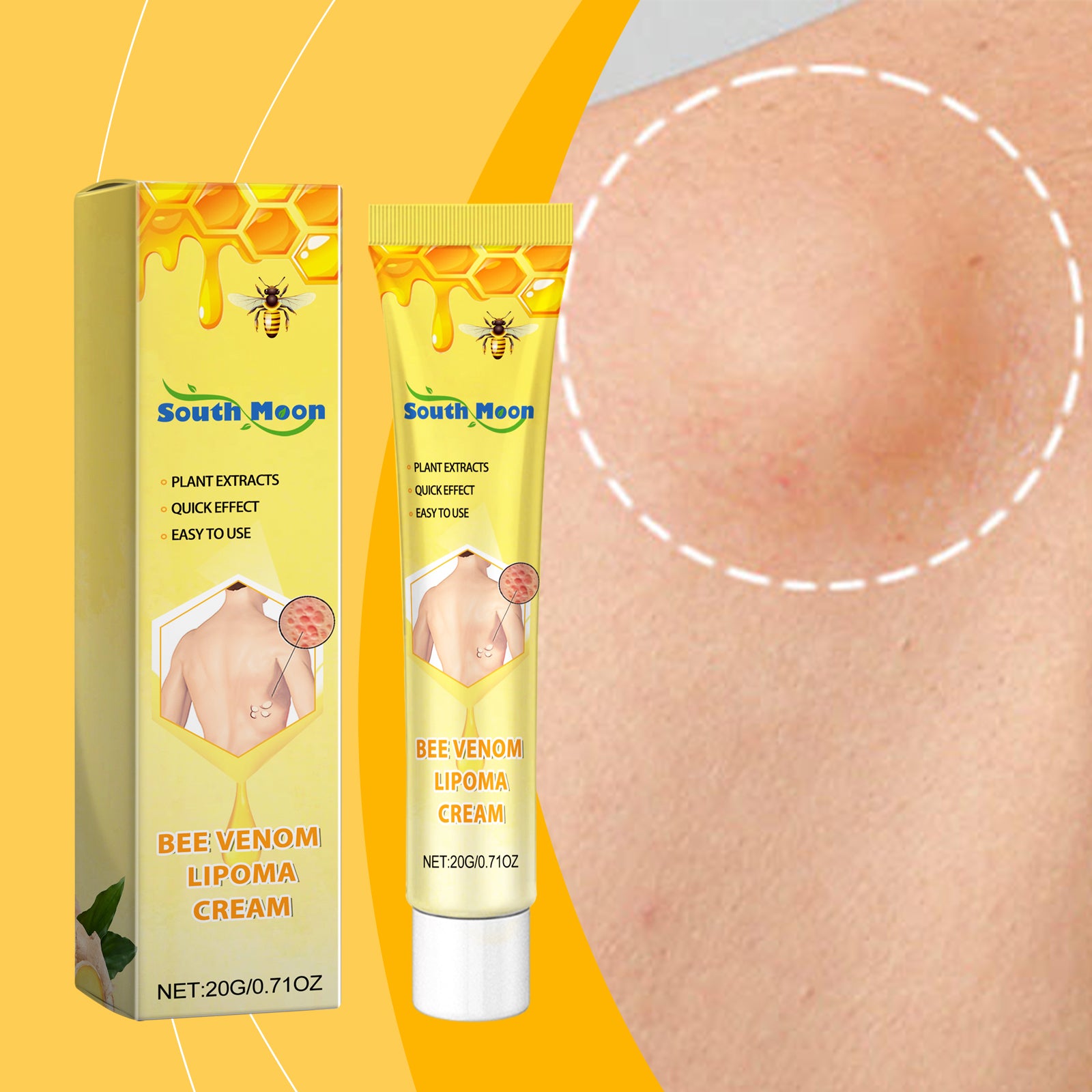 Bee Venom Fat Creme Moisturizes Skin Soothes Clumps Soothing Body Care Cream