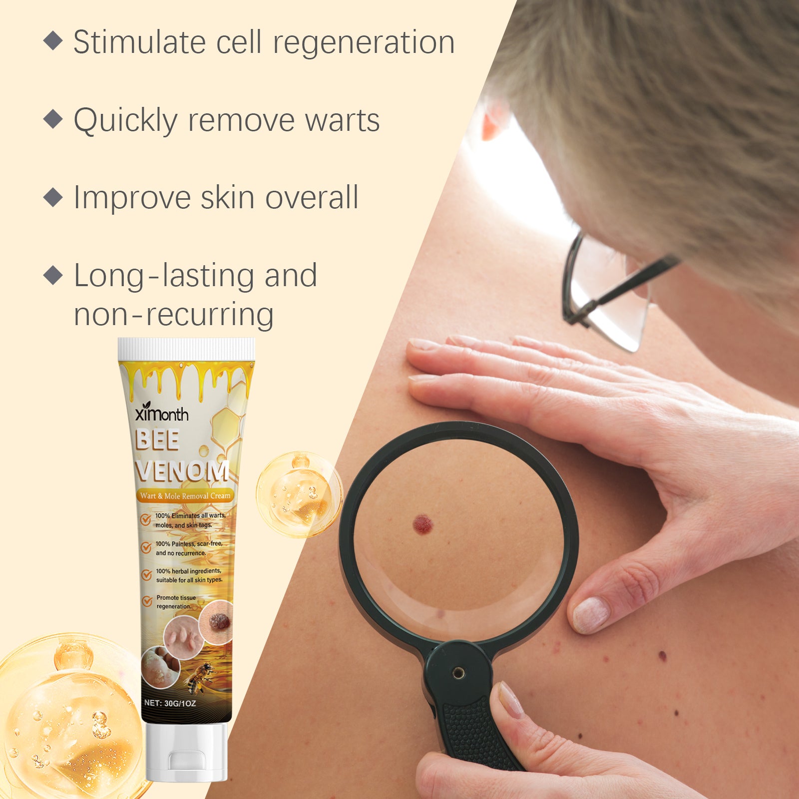 Ximonth Kew Mole Cream Gently Cleanses Skin And Lubrates Rejuvenating Herbal Body Care Cream