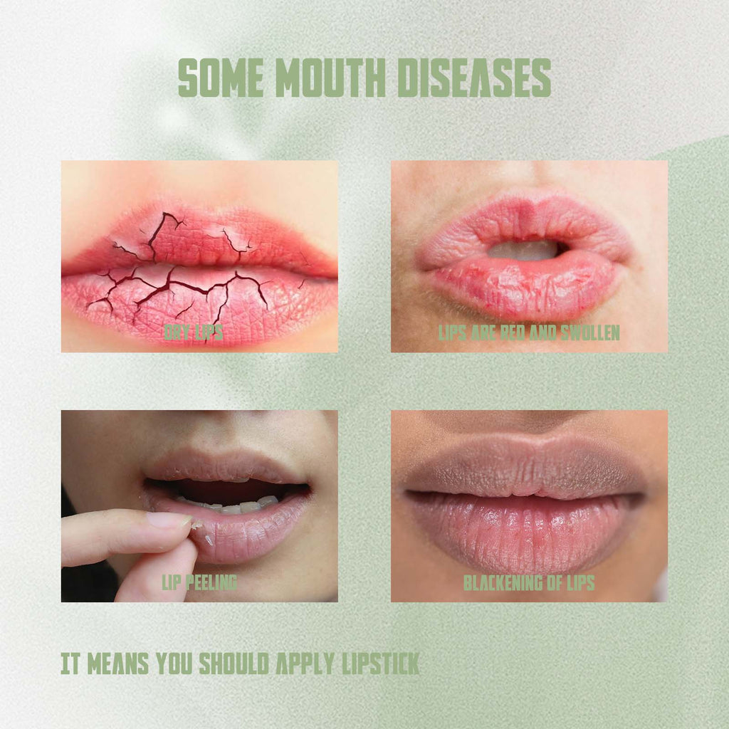 Remove Dark Lip Balm, It Moisturizes Lips Membranes Prevent Weather-Shack Lip Care Lipstick Fade Lip Lines Lip