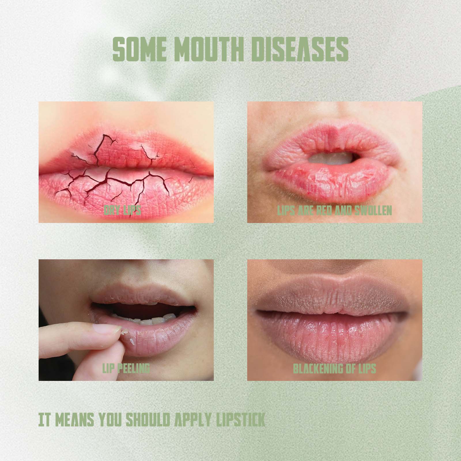 Remove Dark Lip Balm, It Moisturizes Lips Membranes Prevent Weather-Shack Lip Care Lipstick Fade Lip Lines Lip