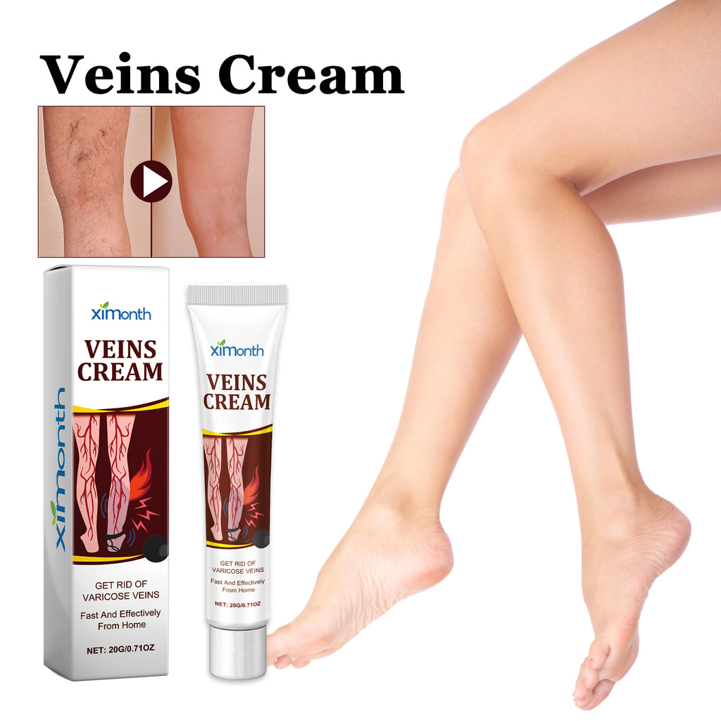 Veins Cream, Relieve The Pain And Discomfort Of Swollen Veins On The Legs
