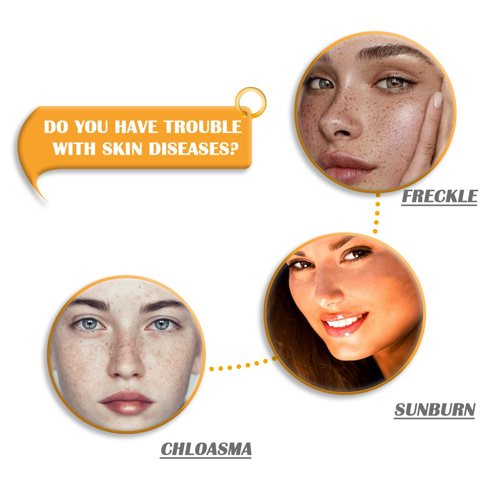 EELHOE Kojic Acid Soap Cleanser Cleansing Soap Dilute Cleansing Cleanser Pore-Clearing Exfoliating Skincare Soap