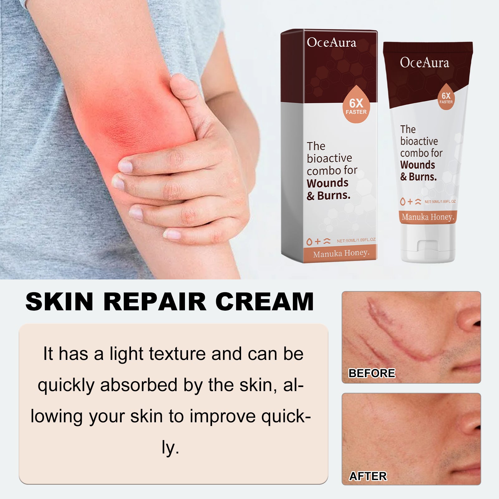 The Bioactive Combo For Wounds& Burns, Alleviate The Brotherhood Of Itchy Skin Redness Itching Repair Body Care Cream