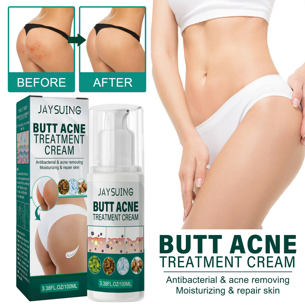 Butt Cream, Moisturizing Lighten Acne Mark Fresh Skin Moisturizing Mild Repair Acne Cream