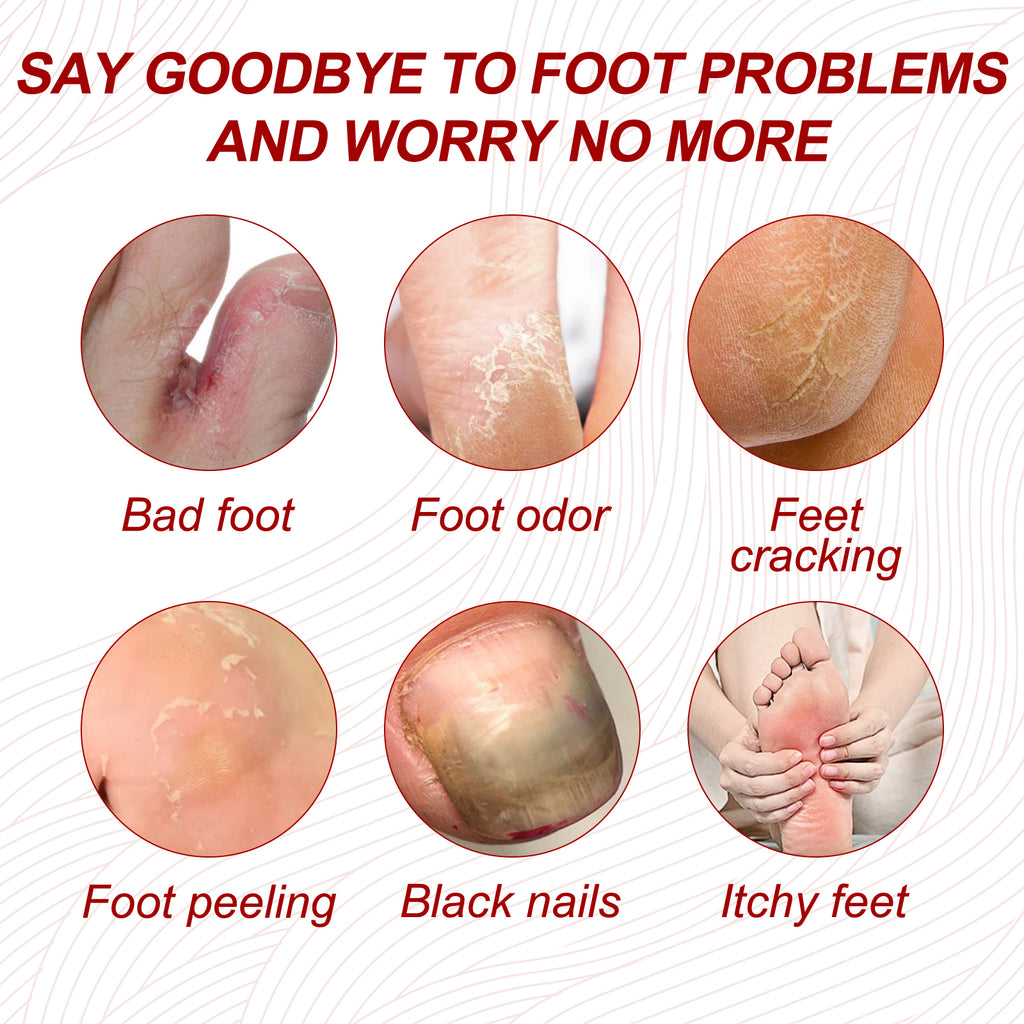 Nail Care Cream, Light Armor Repair Bad Ingrown Nail Nails Brothers Nail Thickening A Ditch Nursing