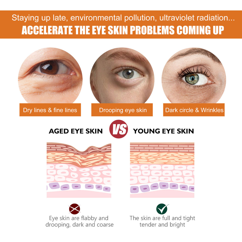 Turmeric Eye Cream Turmeric Vitamin C Moisturizing Eye Cream To Reduce Eye Lines And Care For The Skin Around The Eyes