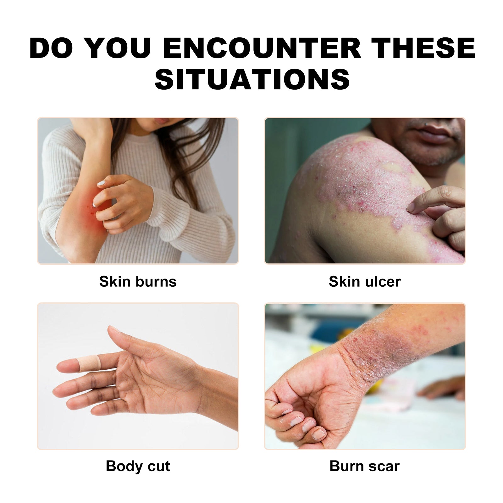 The Bioactive Combo For Wounds& Burns, Alleviate The Brotherhood Of Itchy Skin Redness Itching Repair Body Care Cream