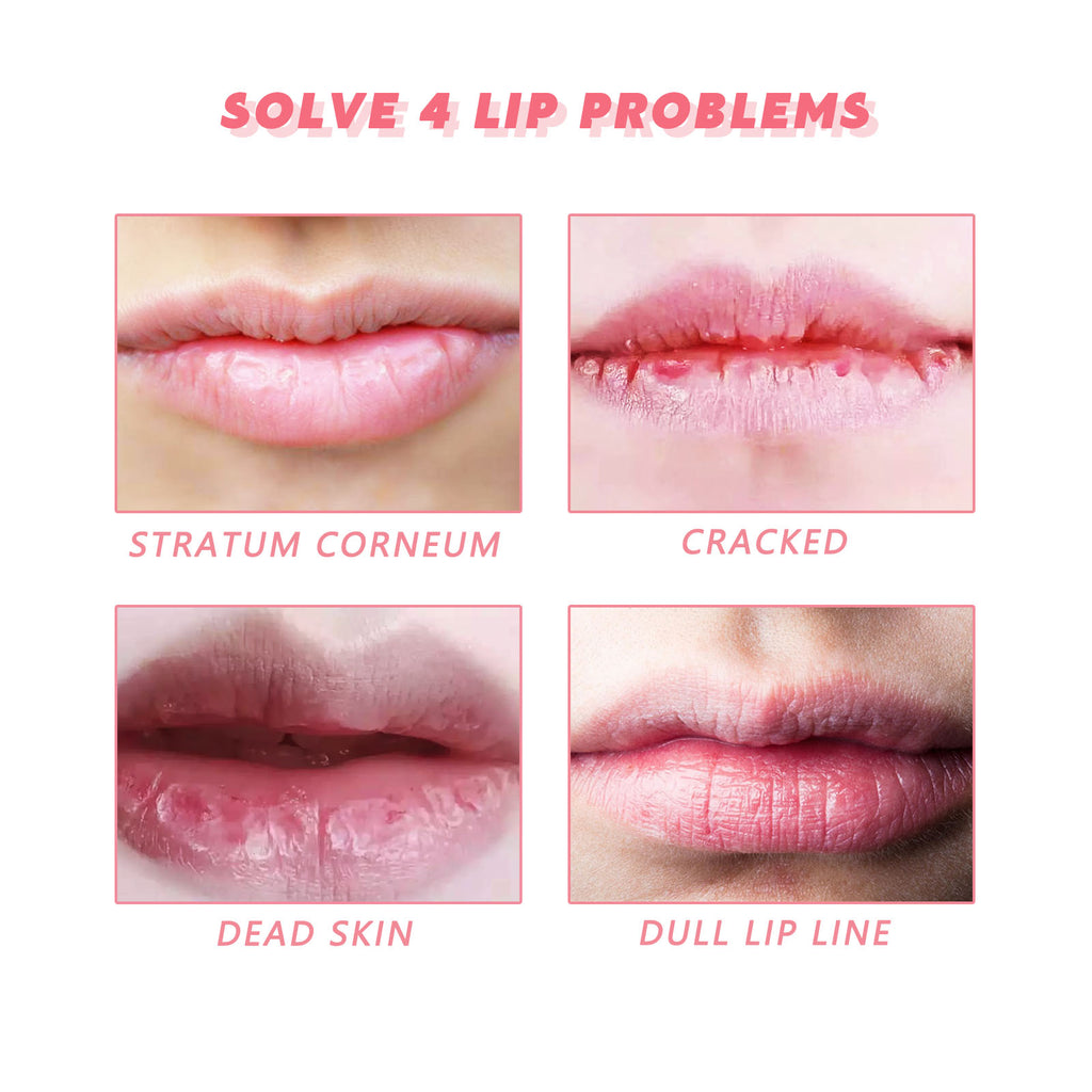 Peach Lip Scrub Moisturizes The Lips, Hydrates The Lips, Lightens The Skin Around The Lips And Improves The Corners Of The Mouth