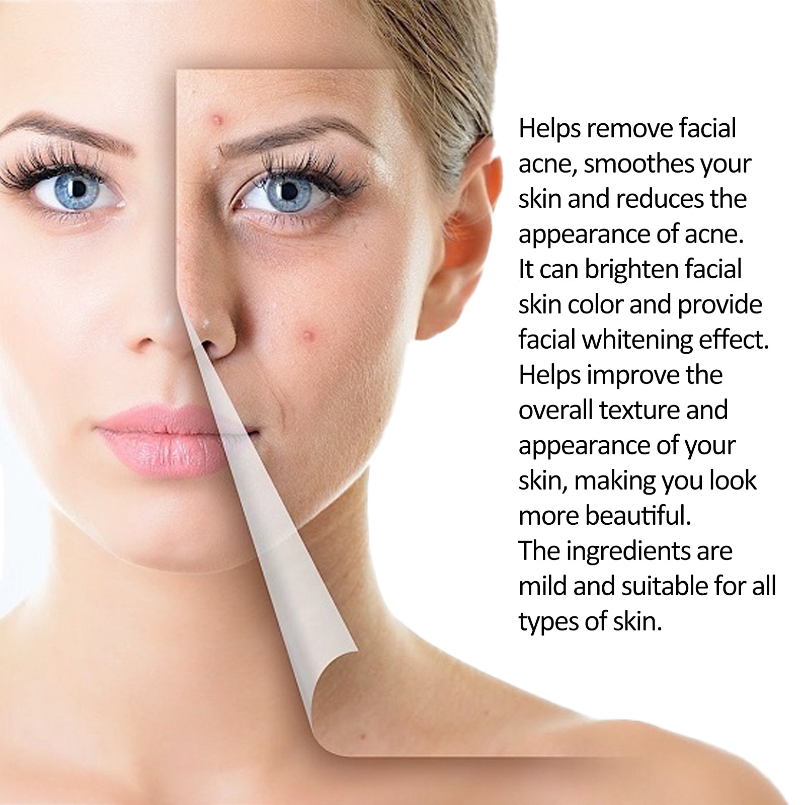 Tea Tree Whitening Acne Repair Relief Serum, Desalt Blain Acne Clean And Tighten Pores Moisturizing Essence