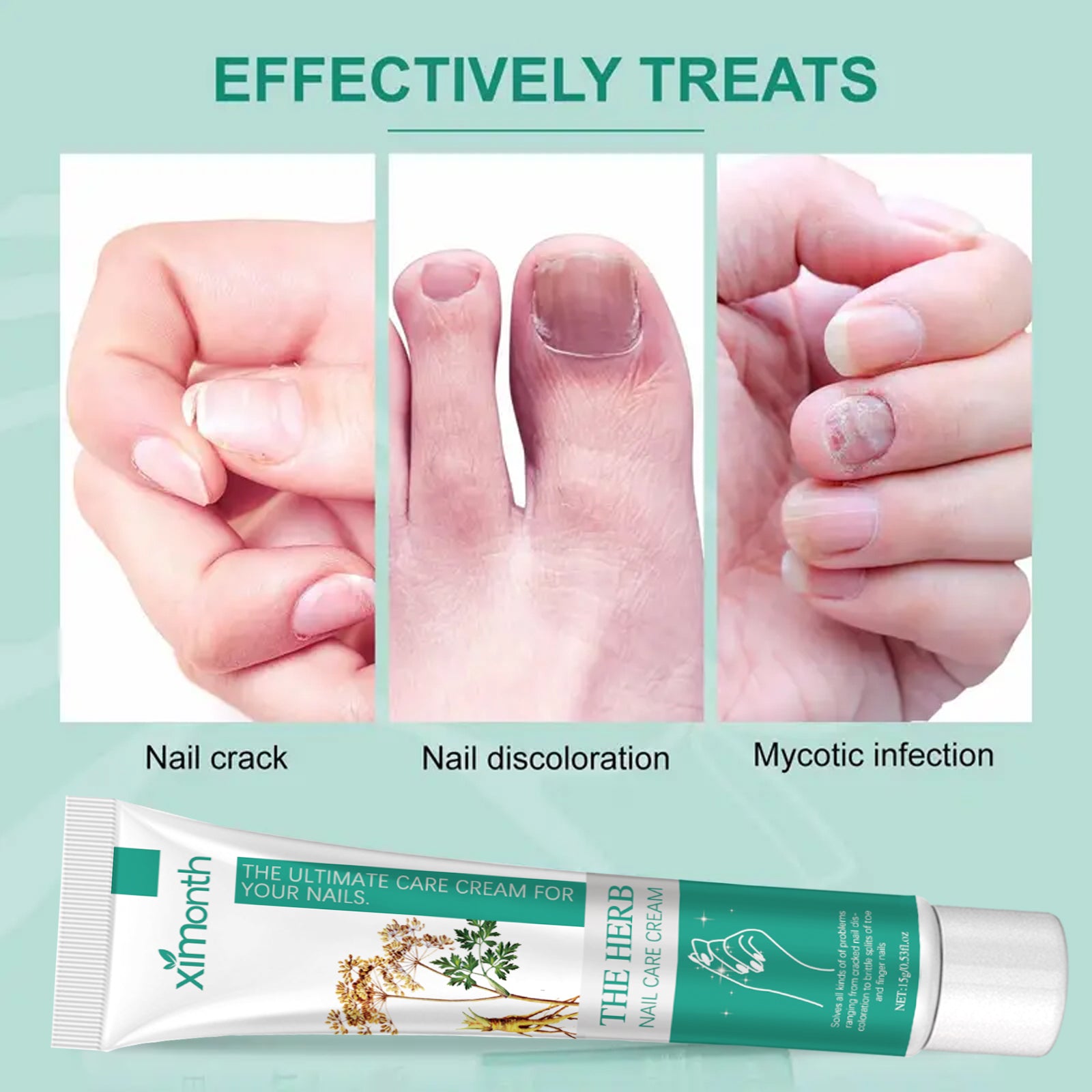 Nail Repair Cream Repair Grey Nails, Soft Nails, Thickening Nails, Pain Relief Nail Care Cream
