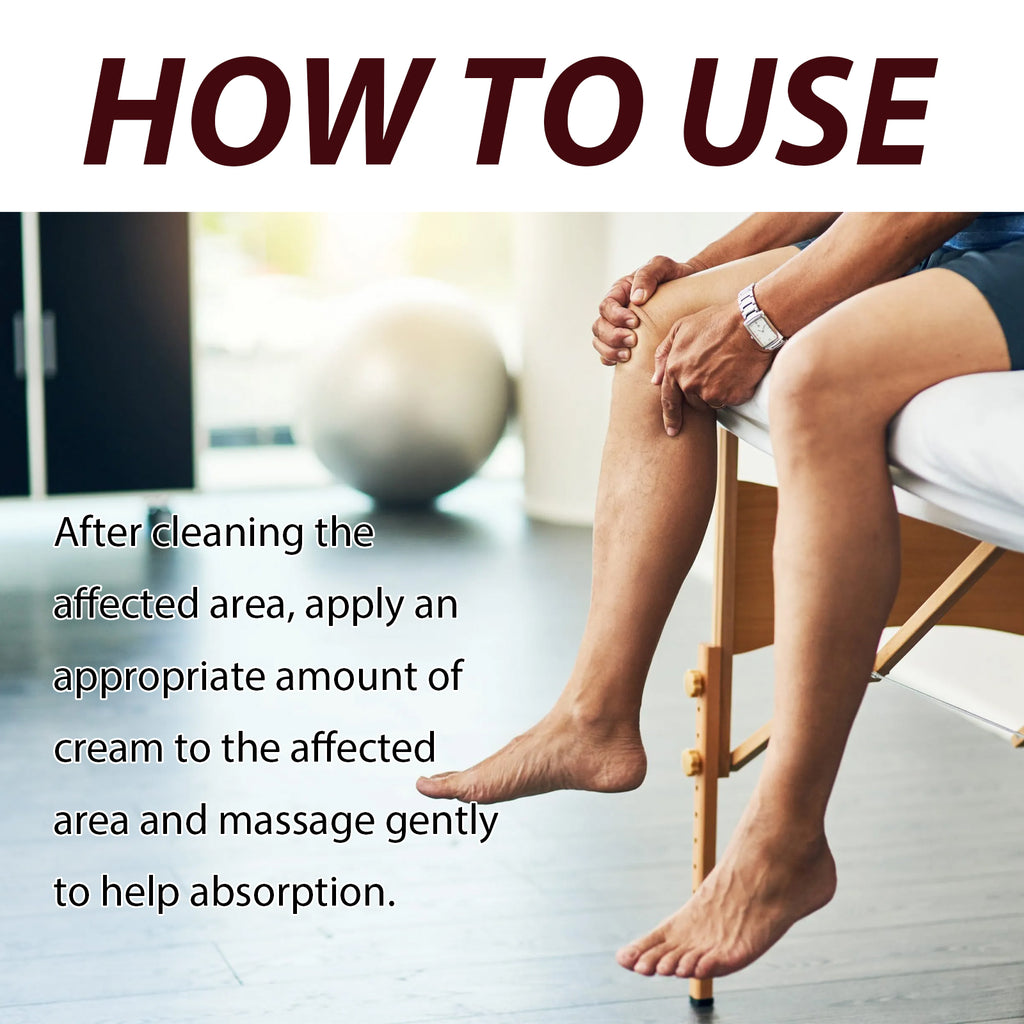 Veins Cream, Relieve The Pain And Discomfort Of Swollen Veins On The Legs