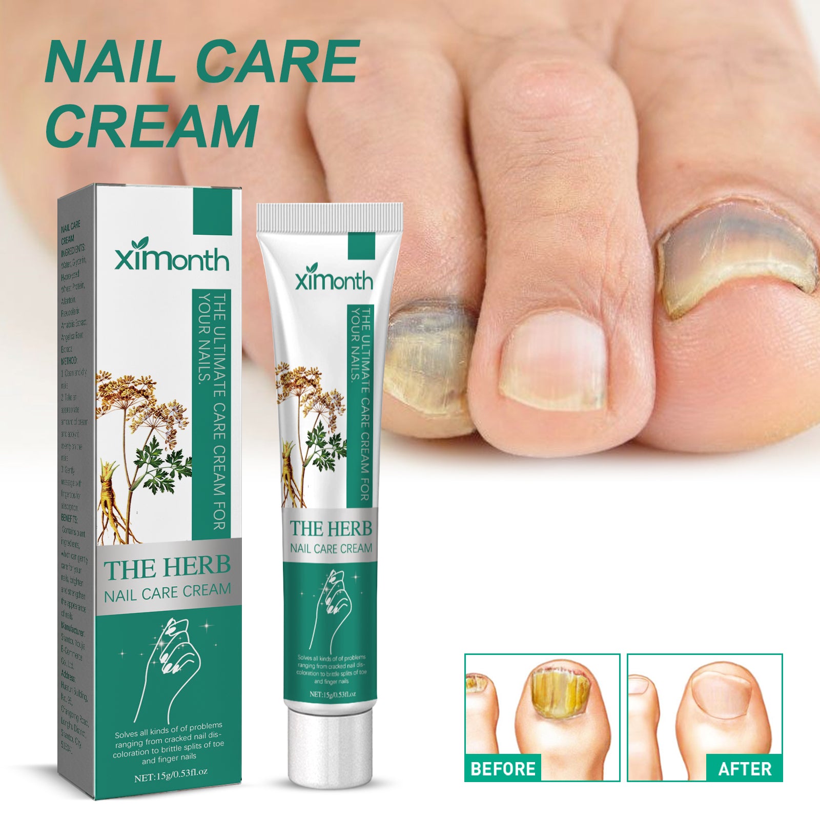 Nail Repair Cream Repair Grey Nails, Soft Nails, Thickening Nails, Pain Relief Nail Care Cream
