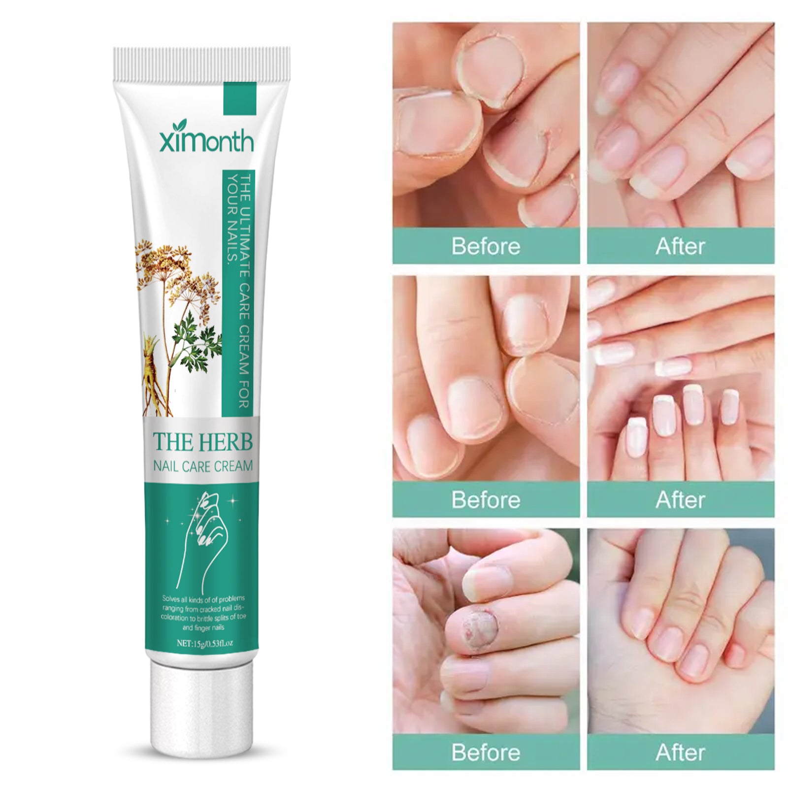 Nail Repair Cream Repair Grey Nails, Soft Nails, Thickening Nails, Pain Relief Nail Care Cream