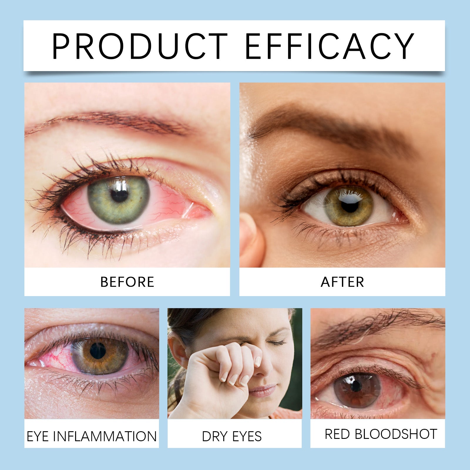 Eye Drops, Eye Moisturizing Drops Relieve Dryness Soothing Moisturizing Maintenance Eye Health Care Solution