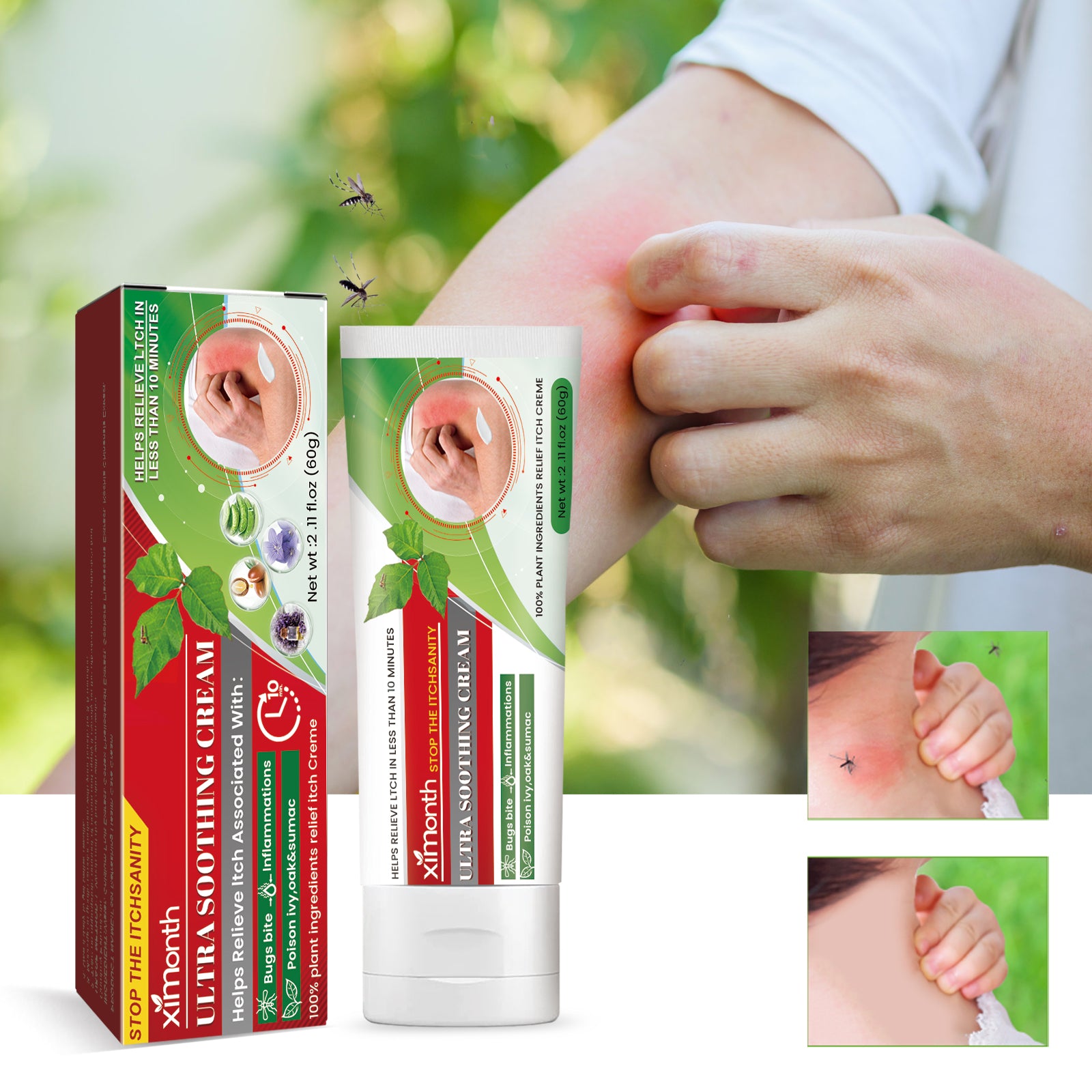 XiMonth Ultra Soothing Cream, Relieve Mosquito Bites Prickly Rash Skin Red And Itchy Skin Care Cream