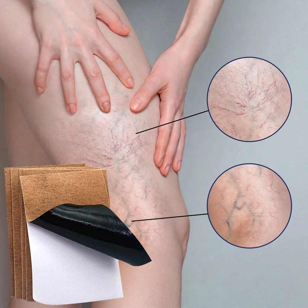Vein Repair Patch To Relieve Pain And Swelling Earthworm Leg Blue Veins Repair Plaster