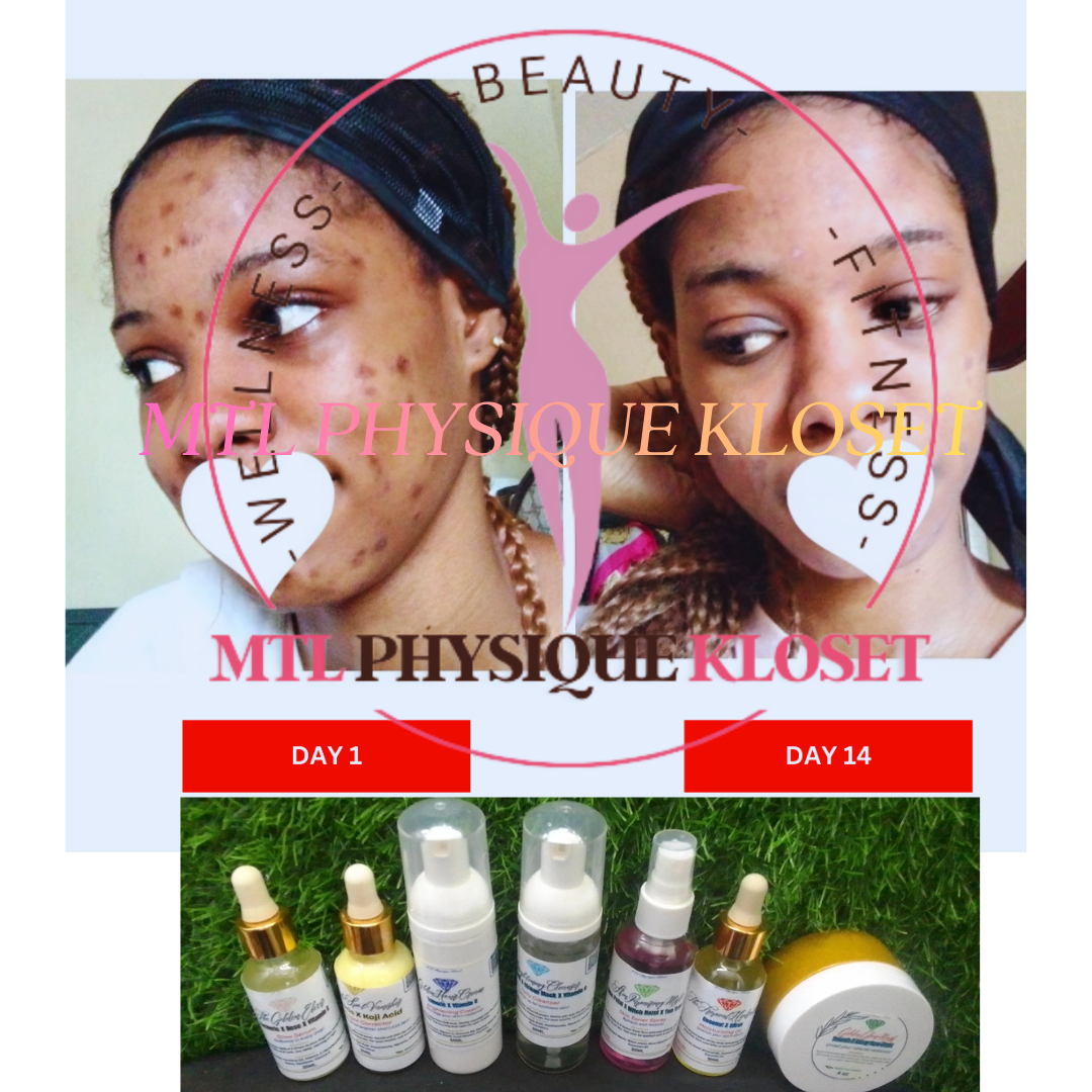 LAVISH SKINCARE BRIGHTENING CREAM OIL SERUM SOAP GEL DARK SPOT REMOVER